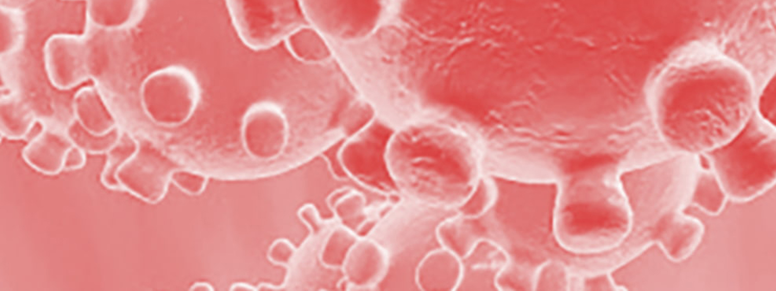 Com ens afecten les mesures de prevenció del Coronavirus